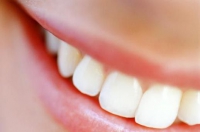 Sorriso